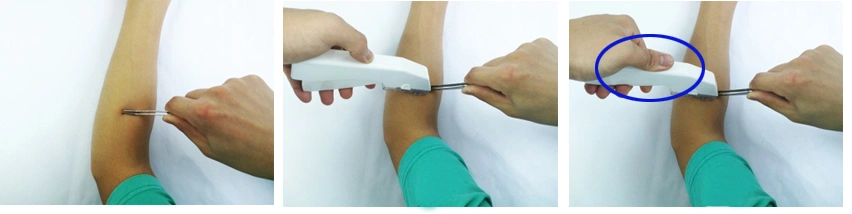Cucitrici meccaniche della pelle medica eliminabile e dispositivi di rimozione chirurgici della cucitrice meccanica con CE