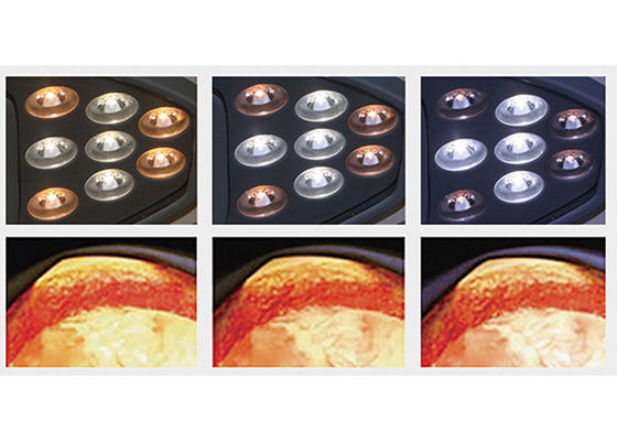 luce di funzionamento chirurgica Shadowless 180VA 4500K di 10000lux LED